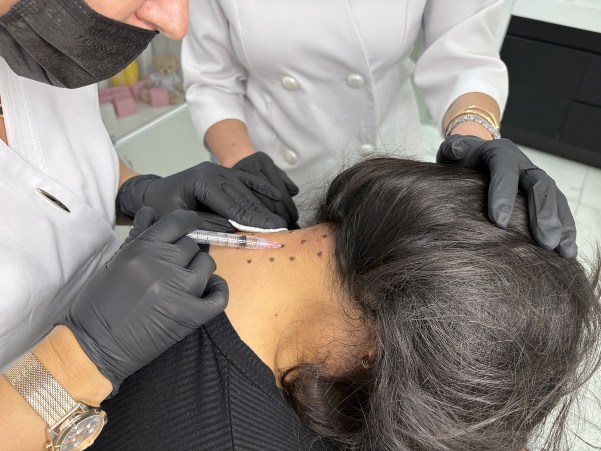 Мезотерапия