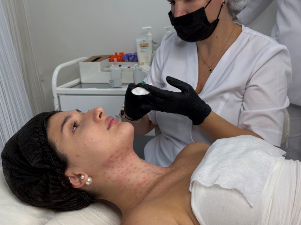 Как косметолог убирает «второй подбородок»?