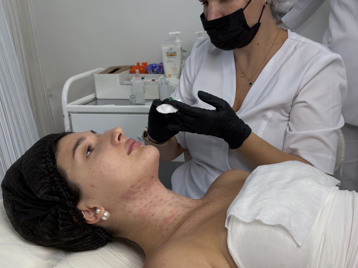 Контурная пластика губ