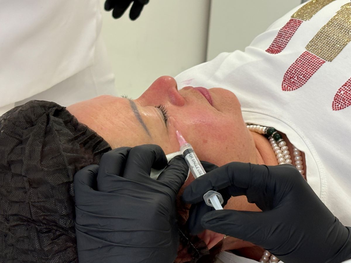 Контурная пластика скул