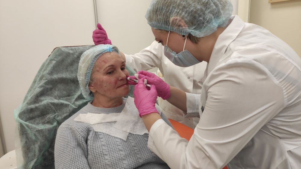 Контурная пластика носогубных складок