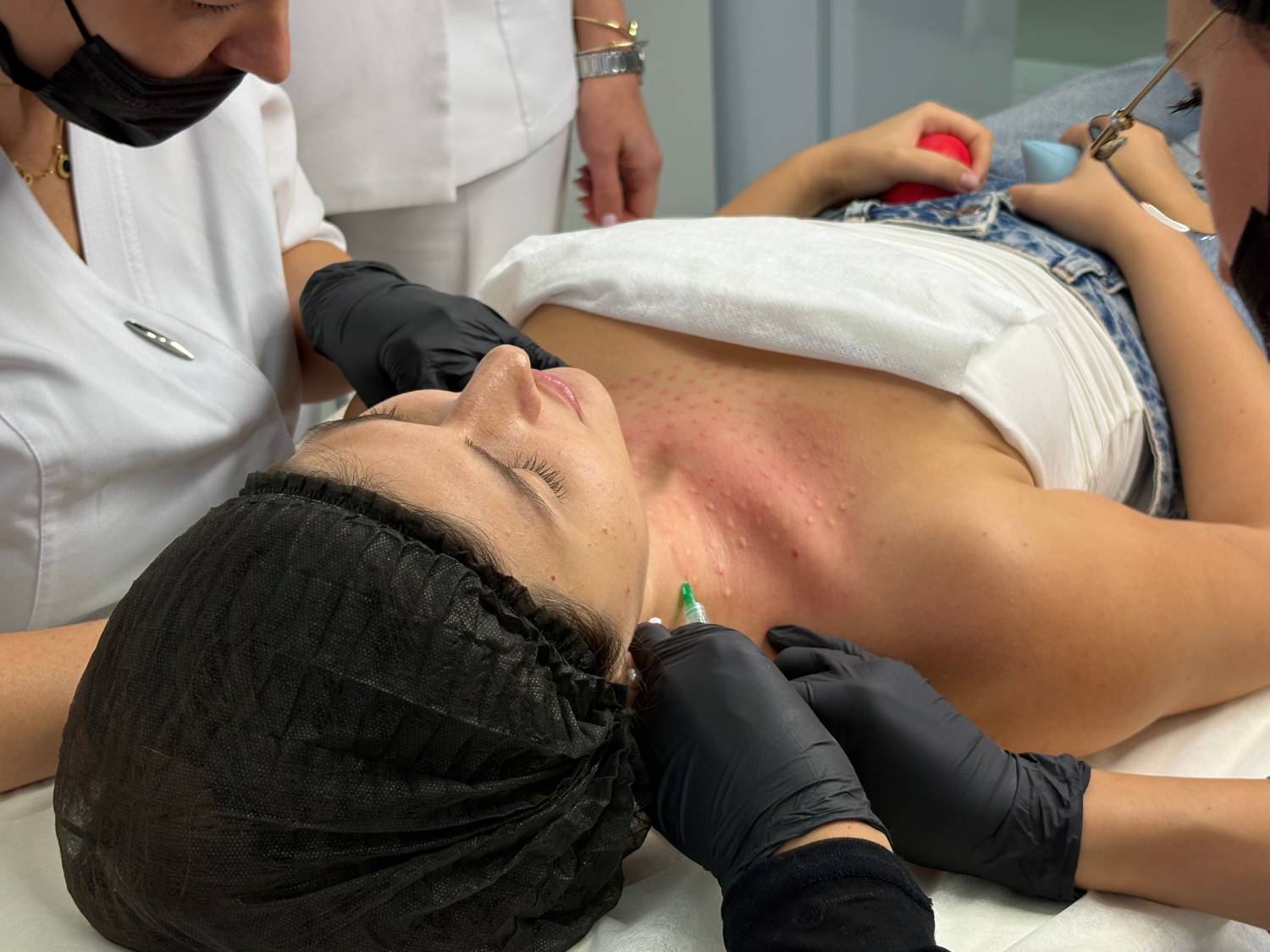 Ботулинотерапия: что это, как появилась и как ей научиться