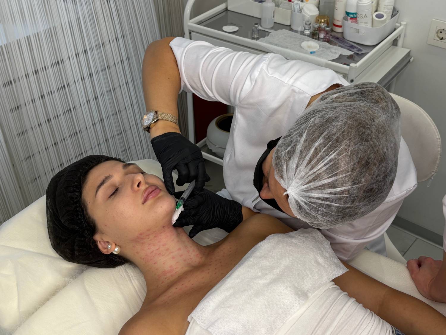 Ботулинотерапия