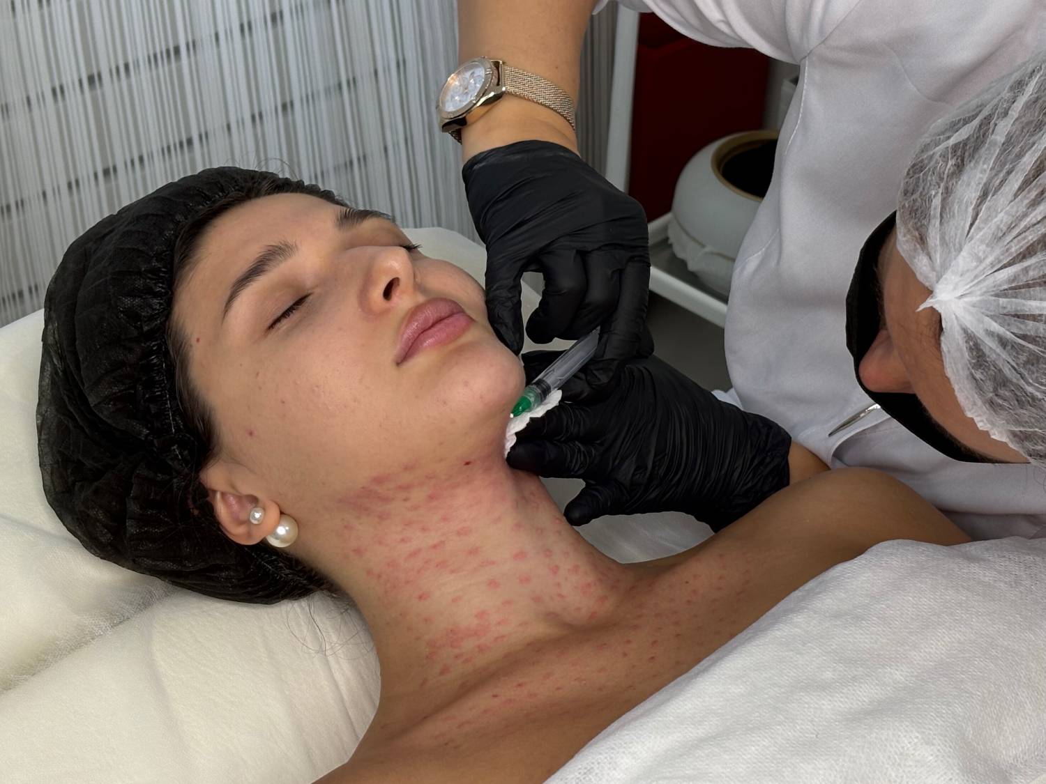 Ботулотоксин 