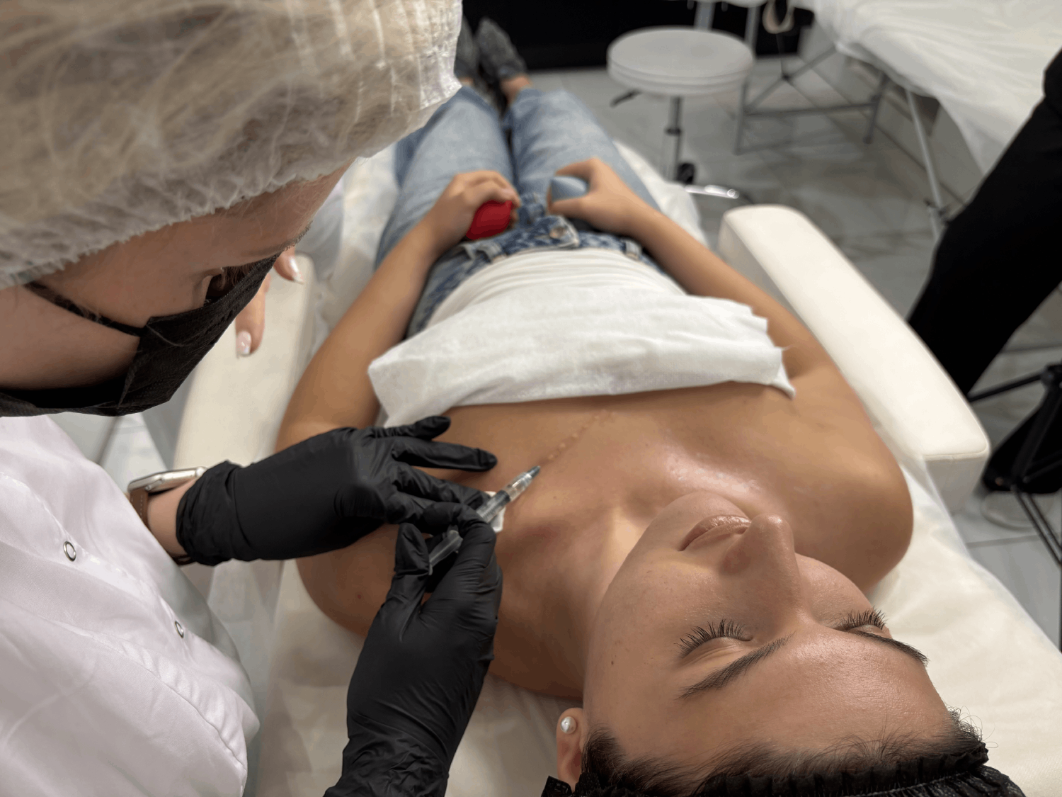 Следы инъекций после мезотерапии