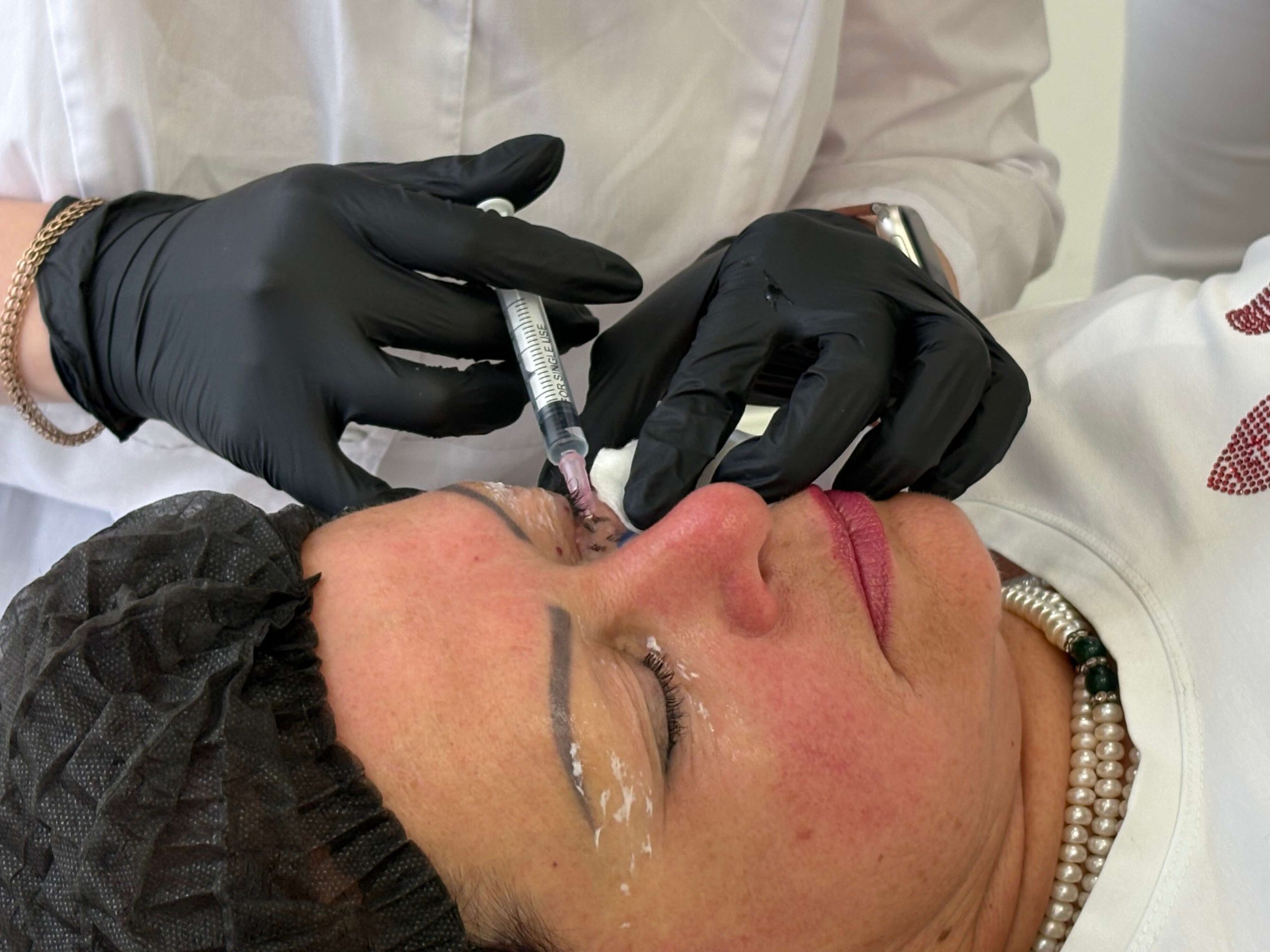 Как подобрать мезококтейль под тип кожи?